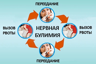 Лечение булимии в Избербаше